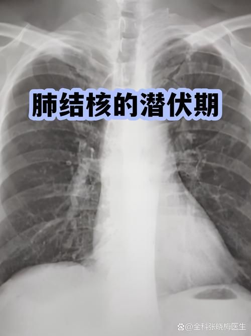鞍山静默区无症状感染者详情_鞍山市疑似病例2例