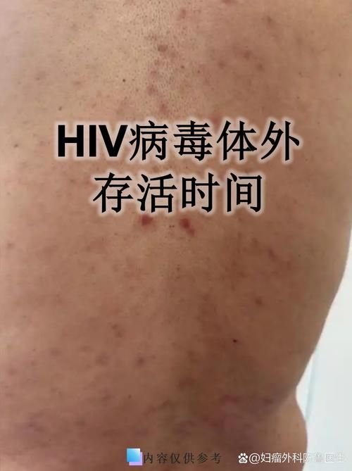 江苏省淮安市洪泽区新增30例核酸阳性及21例无症状:江苏淮安洪泽新型冠状病毒