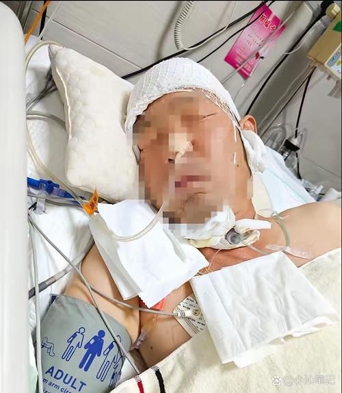  东明县现有重症12例:东明县现有重症12例患者