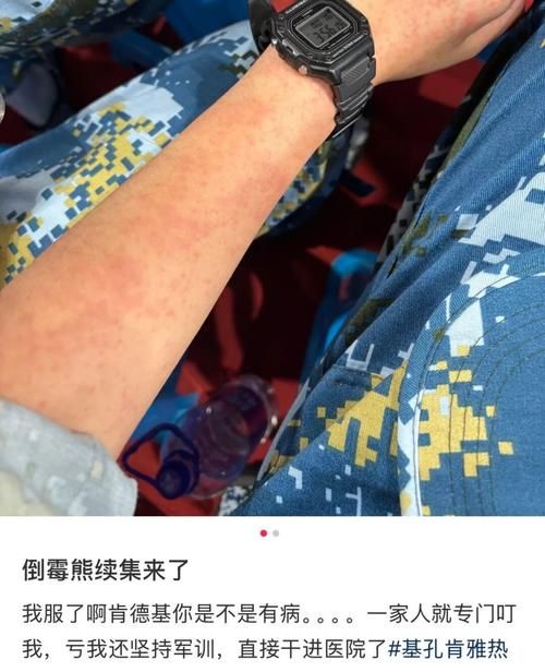 31省份疫情存反弹风险_哪几个省疫情反弹