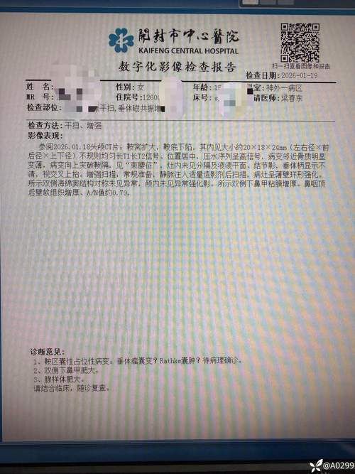 云南省红河哈尼族彝族自治州元阳县新增26例死亡病例及3例无症状(红河州元阳县视频)