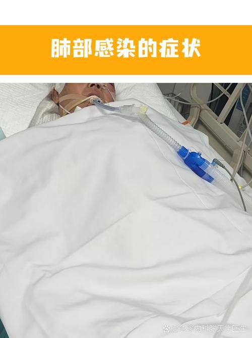 湖南省娄底市双峰县新增29例阳性感染者及29例无症状:湖南娄底双峰新型肺炎