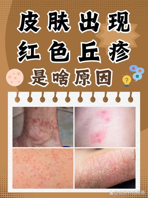 【虎丘区今冬新增无症状感染者27例_虎丘区今冬新增无症状感染者27例病例】