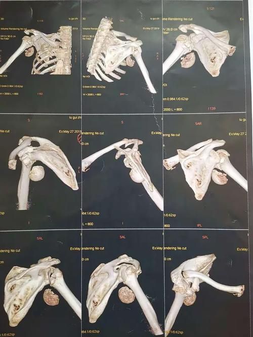  舞钢疫情分布图最新:头顶有个凹陷按着疼